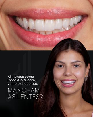 Post sobre manchas nas lentes de contato dental.